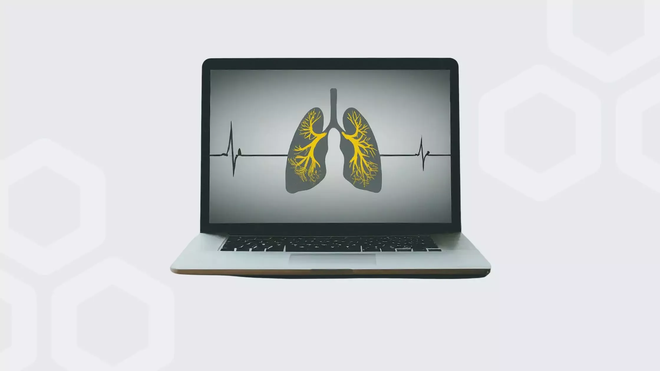 Cost-benefit analysis of at-home COPD monitoring